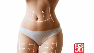 body slimming massage