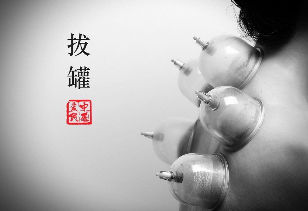 Cupping - Benefits Increases blood circulation Relieve muscle tension Improve overall blood flow Promote cell repair Help form new connective tissues Effective for chronic cough, asthma, bronchial congestio