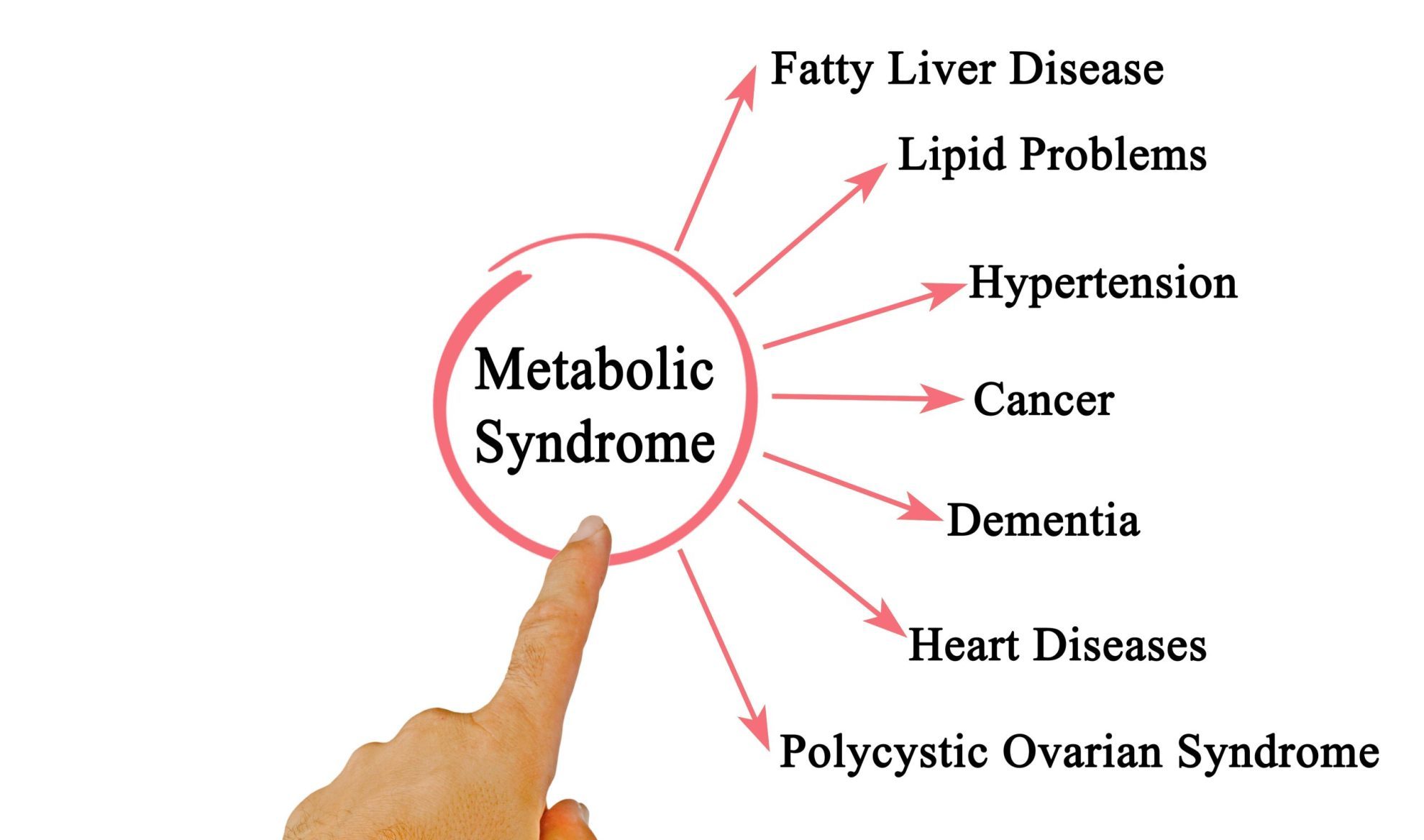 type-of-Metabolic-Syndrome