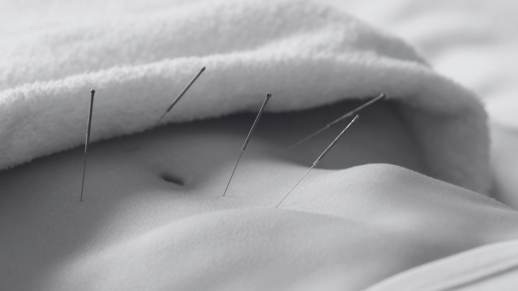 slimming accupunture