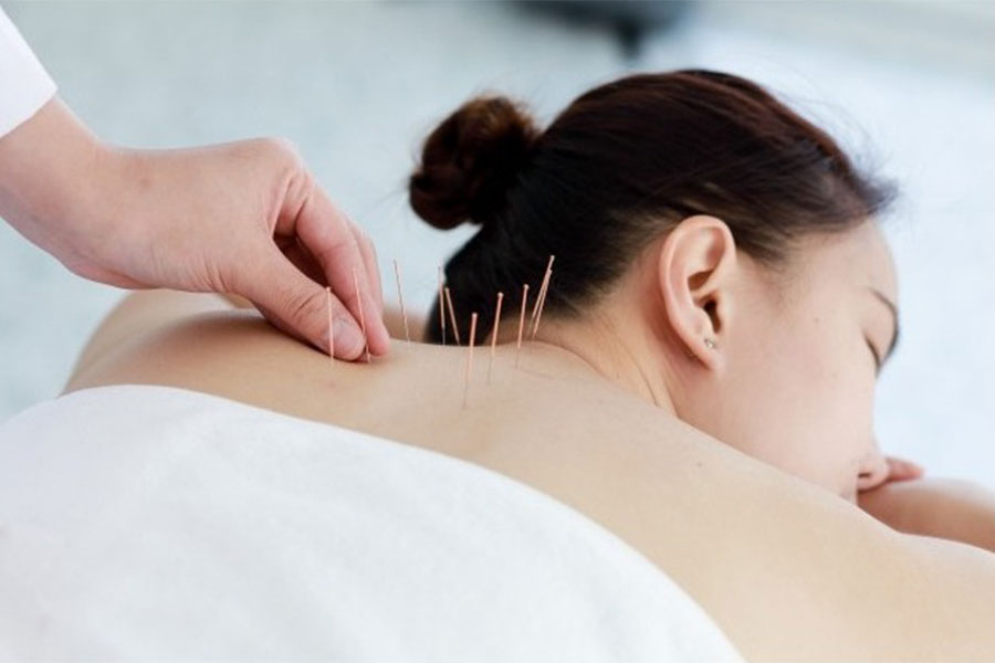 undergo acupuncture treatment in singapore